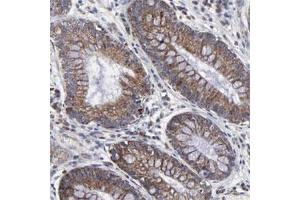 Immunohistochemical staining of human stomach with ZNF550 polyclonal antibody  shows cytoplasmic positivity in glandular cells. (ZNF550 抗体)