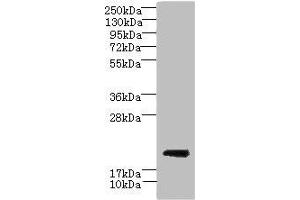 Western blot All lanes: CYBC1 antibody at 1. (CYBC1 (AA 43-187) 抗体)