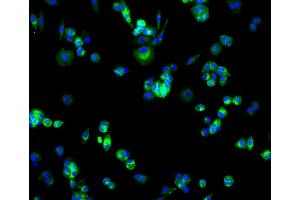 Immunofluorescence (IF) image for anti-Solute Carrier Family 2 (Facilitated Glucose Transporter), Member 1 (SLC2A1) antibody (ABIN5997112)