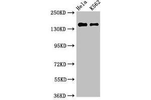 Western Blot Positive WB detected in: Hela whole cell lysate, K562 whole cell lysate All lanes: EEA1 antibody at 3 μg/mL Secondary Goat polyclonal to rabbit IgG at 1/50000 dilution Predicted band size: 163 kDa Observed band size: 163 kDa (EEA1 抗体  (AA 734-875))
