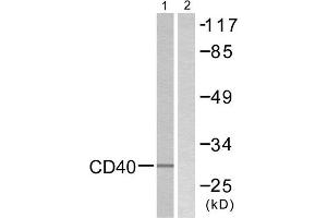 Western Blotting (WB) image for anti-CD40 (CD40) (C-Term) antibody (ABIN1848816) (CD40 抗体  (C-Term))