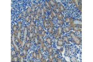 Used in DAB staining on fromalin fixed paraffin- embedded kidney tissue (CXCL11 抗体  (AA 22-100))