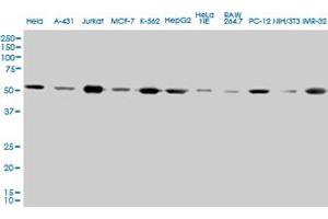 TUBA1 monoclonal antibody (M01), clone 2E11. (TUBA4A 抗体  (AA 1-448))