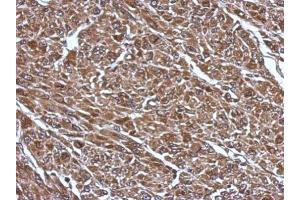 IHC-P Image Immunohistochemical analysis of paraffin-embedded U87 xenograft, using RABGGTB, antibody at 1:500 dilution. (RABGGTB 抗体)