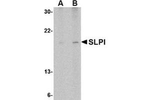 Image no. 1 for anti-Secretory Leukocyte Peptidase Inhibitor (SLPI) (Middle Region) antibody (ABIN318889) (SLPI 抗体  (Middle Region))