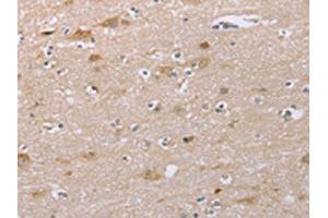 The image on the left is immunohistochemistry of paraffin-embedded Human brain tissue using ABIN7192262(SAMD9L Antibody) at dilution 1/30, on the right is treated with synthetic peptide. (SAMD9L 抗体)
