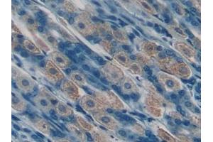 Immunohistochemistry (IHC) image for anti-Phospholipase A2, Group VI (Cytosolic, Calcium-Independent) (PLA2G6) (AA 481-702) antibody (ABIN7431761)
