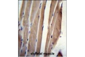 Immunohistochemistry (Paraffin-embedded Sections) (IHC (p)) image for anti-Polymerase (RNA) II (DNA Directed) Polypeptide J, 13.3kDa (POLR2J) (AA 86-115), (C-Term) antibody (ABIN655247)