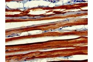 Immunohistochemistry of paraffin-embedded human skeletal muscle tissue using ABIN7160604 at dilution of 1:100 (MYBPC2 抗体  (AA 739-1141))