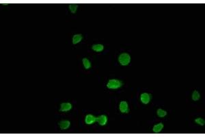 Immunofluorescence staining of A549 cells with ABIN7176586 at 1:100, counter-stained with DAPI. (GLIS3 抗体  (AA 527-663))