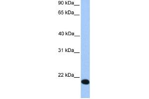 WB Suggested Anti-ZNF833P Antibody Titration:  0. (LOC401898 抗体  (Middle Region))