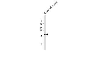 Anti-NACA2 Antibody (N-Term) at 1:2000 dilution + human skeletal muscle lysate Lysates/proteins at 20 μg per lane.