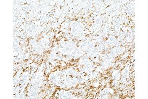 Immunohistochemistry (IHC) image for anti-Protein tyrosine Phosphatase, Receptor Type, C (PTPRC) (AA 1254-1304) antibody (ABIN7455221)