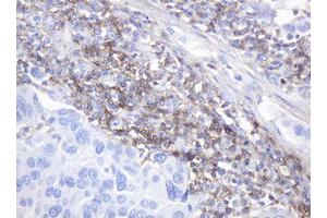 Image no. 3 for anti-CD99 (CD99) antibody (ABIN1497382)