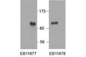 Western Blotting (WB) image for anti-Hypermethylated in Cancer 1 (HIC1) (AA 193-204) antibody (ABIN5868799) (HIC1 抗体  (AA 193-204))