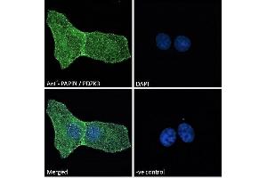 ABIN185158 Immunofluorescence analysis of paraformaldehyde fixed U2OS cells, permeabilized with 0. (PDZD2 抗体  (N-Term))