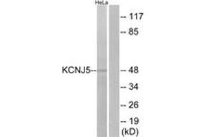 Western blot analysis of extracts from HeLa cells, using KCNJ5 Antibody. (KCNJ5 抗体  (AA 370-419))