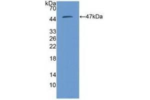 Detection of Recombinant PSMD13, Human using Polyclonal Antibody to Proteasome 26S Subunit, Non ATPase 13 (PSMD13) (PSMD13 抗体  (AA 1-378))