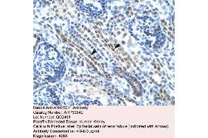 Human kidney (ANKRD11 抗体  (N-Term))