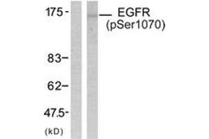 Western blot analysis of extracts from SK-OV3 cells treated with EGF, using EGFR (Phospho-Ser1070) Antibody. (EGFR 抗体  (pSer1070))