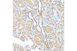 Immunohistochemistry of paraffin-embedded mouse kidney using Sec23AA Rabbit mAb (ABIN7270168) at dilution of 1:100 (40x lens). (SEC23A 抗体)