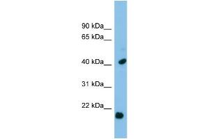 WB Suggested Anti-HSPB2 Antibody Titration: 0. (HSPB2 抗体  (Middle Region))