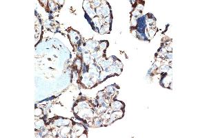Immunohistochemistry of paraffin-embedded human placenta using  Rabbit mAb (ABIN7265406) at dilution of 1:100 (40x lens). (ATF5 抗体)