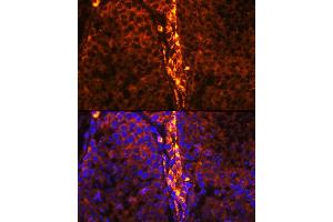 Immunofluorescence analysis of mouse testis using RBP1 Rabbit pAb (ABIN6129597, ABIN6146795, ABIN6146796 and ABIN6214136) at dilution of 1:100 (40x lens). (RBP1 抗体  (AA 63-197))