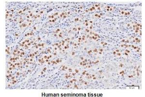 Paraffin embedded sections of human seminoma tissue were initrocelluloseubated with anti-human Nanog (1:50) for 2 hours at room temperature. (Nanog 抗体  (AA 1-154))