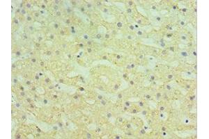 Immunohistochemistry of paraffin-embedded human liver tissue using ABIN7155969 at dilution of 1:100 (HYAL1 抗体  (AA 136-435))