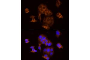 Immunofluorescence analysis of MCF7 cells using DTYMK Rabbit mAb (ABIN7266735) at dilution of 1:25 (40x lens). (DTYMK 抗体)