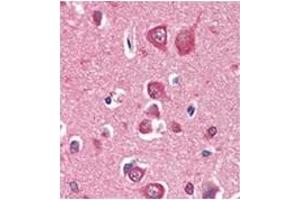 Immunohistochemistry (IHC) image for anti-PTEN Induced Putative Kinase 1 (PINK1) antibody (ABIN356391) (PINK1 抗体)