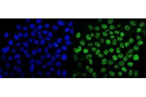 IF analysis of SUMO2/3 using anti-SUMO2/3 antibody (ABIN7600856). (SUMO2/3 抗体  (AA 24-72))