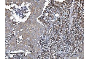 IHC analysis of EHD3 using anti-EHD3 antibody (ABIN7602777). (EHD3 抗体  (C-Term))