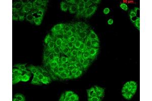 Immunocytochemistry/Immunofluorescence analysis using Mouse Anti-CD74 Monoclonal Antibody, Clone PIN 1. (CD74 抗体  (HRP))
