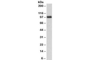 Western blot testing of peripheral blood lymphocyte lysate with CSF3R antibody at 1ug/ml. (CSF3R 抗体)