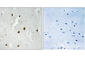 Immunohistochemistry analysis of paraffin-embedded human brain, using FOXO4 (Phospho-Ser262) Antibody. (FOXO4 抗体  (pSer262))