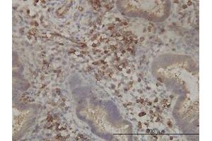 Image no. 1 for anti-Pantothenate Kinase 2 (PANK2) (AA 205-260) antibody (ABIN599308) (PANK2 抗体  (AA 205-260))