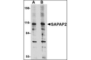Western blot analysis of SAPAP2 in L1210 cell lysate with this product at (A) 0. (DLGAP2 抗体  (Center))