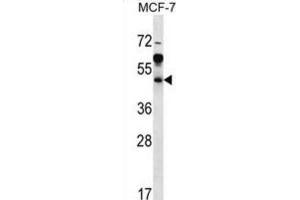 Western Blotting (WB) image for anti-ADP-Ribosylation Factor Interacting Protein 1 (ARFIP1) antibody (ABIN2997067) (ARFIP1 抗体)