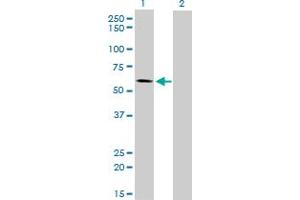 Western Blotting (WB) image for anti-Alkaline Phosphatase, Placental-Like 2 (ALPPL2) (AA 365-455) antibody (ABIN769091) (ALPPL2 抗体  (AA 365-455))