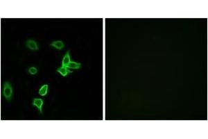 Immunofluorescence analysis of A549 cells, using KANK2 Antibody. (KANK2 抗体  (AA 351-400))