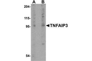 Western blot analysis of TNFAIP3 in rat lung tissue lysate with this product at (A) 1 and (B) 2 μg/ml. (TNFAIP3 抗体  (Center))