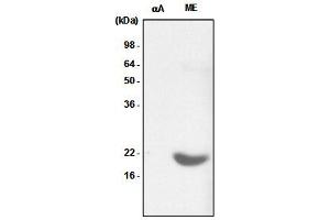 Recombinant crystallin alpha A (alphaA) and the extract of mouse eye (ME) were resolved by SDS-PAGE, transferred to PVDF membrane and probed with anti-human crystallin alpha B antibody (1:1,000). (CRYAB 抗体)