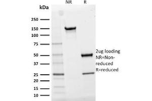 SDS-PAGE Analysis Purified CD25 Mouse Monoclonal Antibody (IL2RA/2395). (CD25 抗体  (AA 42-183))