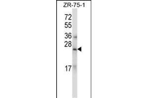 RLN1/RLN2 Antibody (C-term) (ABIN657785 and ABIN2846759) western blot analysis in ZR-75-1 cell line lysates (35 μg/lane). (RLN1,RLN2 抗体  (C-Term))
