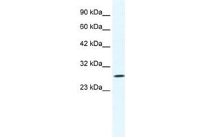 WB Suggested Anti-CLIC1 Antibody Titration:  1. (CLIC1 抗体  (N-Term))