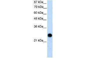 Western Blotting (WB) image for anti-Voltage-Dependent Anion Channel 2 (VDAC2) (N-Term) antibody (ABIN633626)