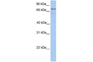 WB Suggested Anti-TGM7 Antibody Titration:  0. (Transglutaminase 7 抗体  (C-Term))