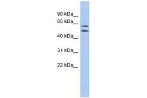 Image no. 1 for anti-Abhydrolase Domain Containing 15 (ABHD15) (AA 107-156) antibody (ABIN6743745) (ABHD15 抗体  (AA 107-156))